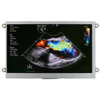 Newhaven Display Intl NHD-7.0-HDMI-N-RSXP